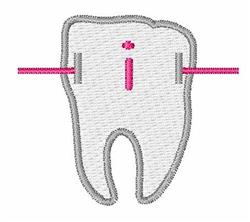 Braces Small i - 4x4 brace quick stitch machine embroidery design for cute baby onesies