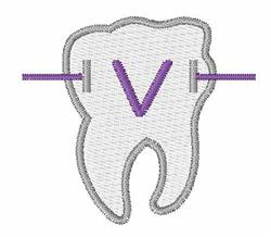 quick stitch brace machine embroidery pattern - Braces V perfect for cute baby onesies